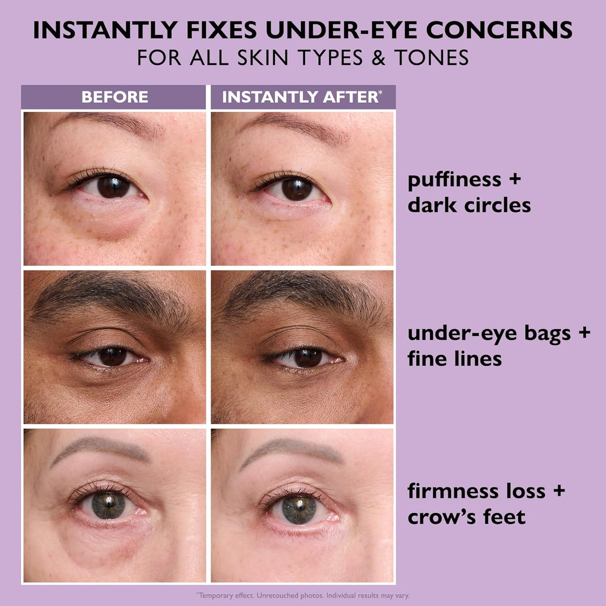 How to use Instant Eye Lift Cream – Smooths Bags & Fine Lines