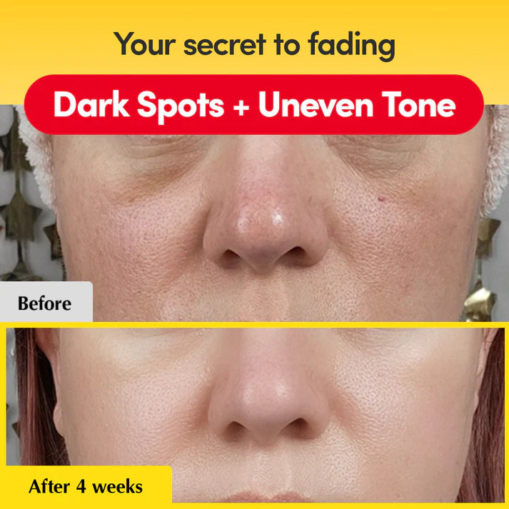 Before and after appearance of dark spots and uneven-looking tone