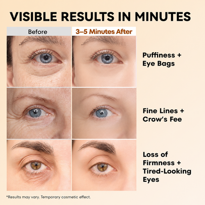 Instant Eye Tightener – Smooths Eye Bags, Puffiness & Fine Lines in 3–5 Minutes, 0.67 oz