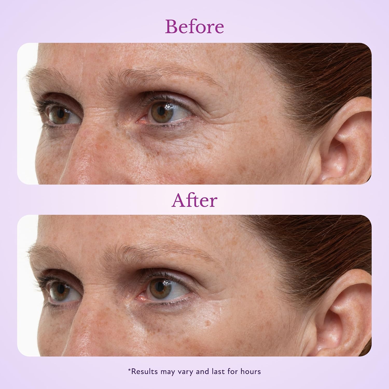 Side view before and after applying eye firming gel