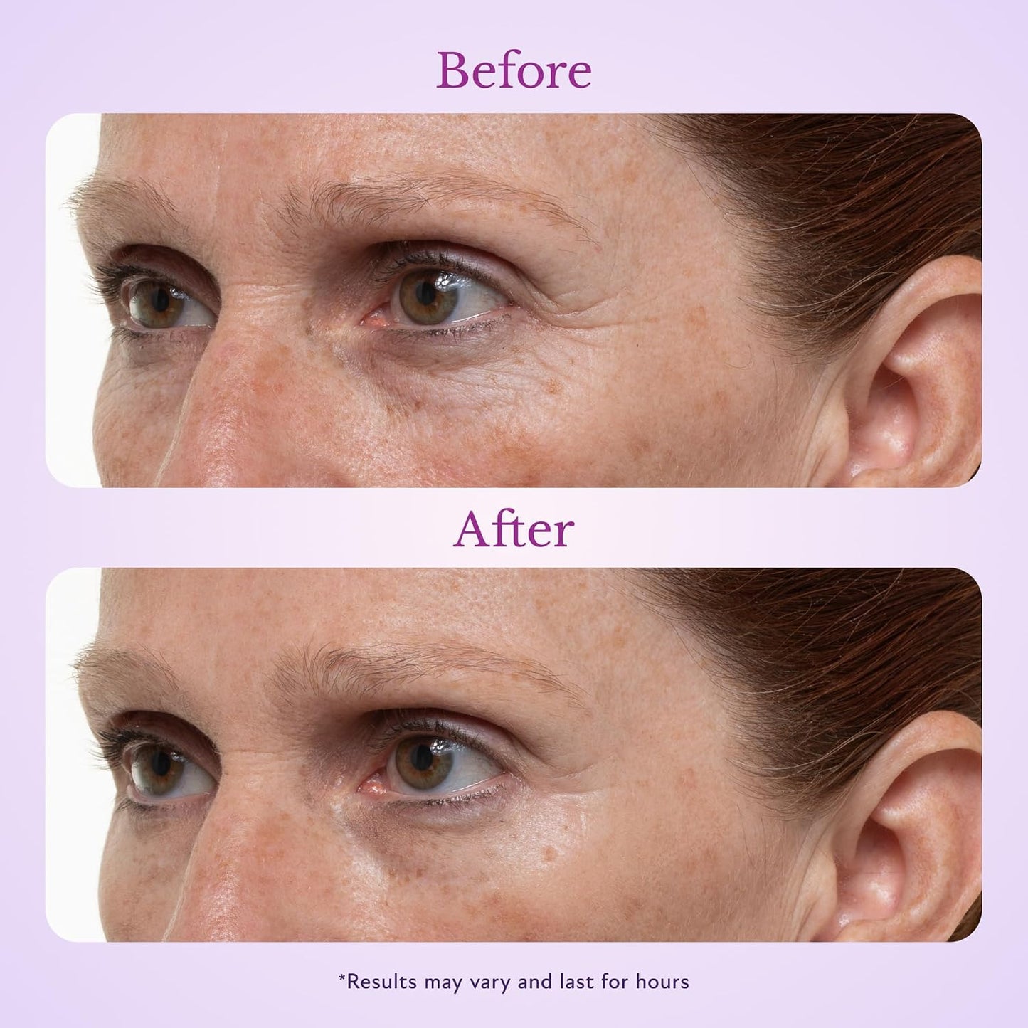Tinted Firming Eye Gel for Puffiness & Under-Eye Bags, Light–Medium, 0.33 fl oz